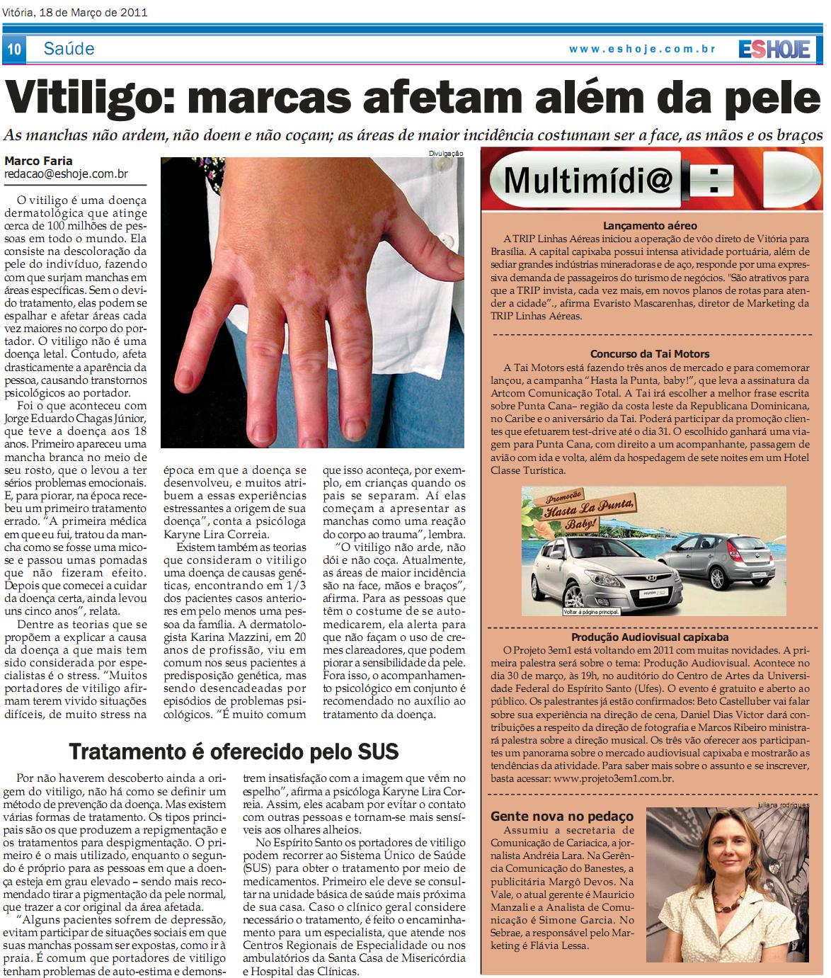 Entrevista sobre vitiligo para o Jornal Espírito Santo Hoje